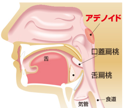のどの病気 愛知県瀬戸市の耳鼻咽喉科 気管食道科 こだま耳鼻科クリニック